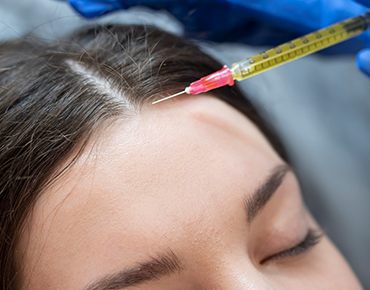 PRP Hair Treatment in Gachibowli